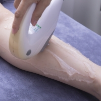 Hair Removal